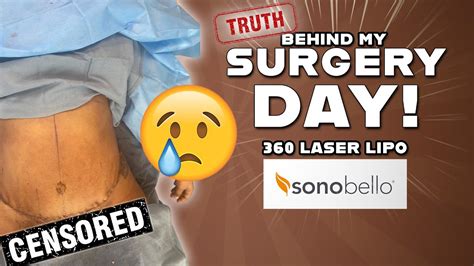 sonobello in charlotte nc|sono bello laser lipo reviews.